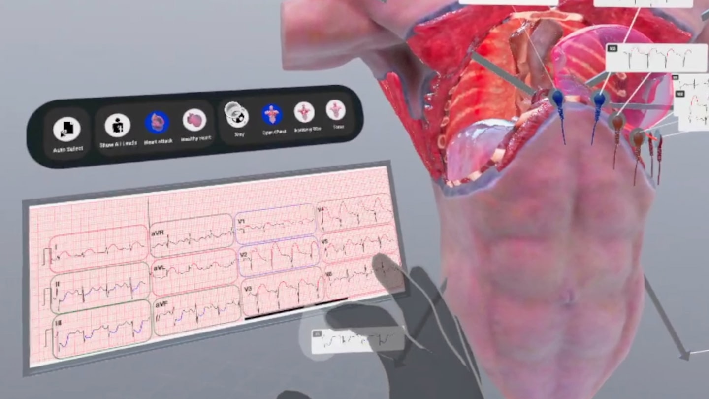 #2. Understanding Heart Attack (Meta) Door: XR Anatomy Ltd