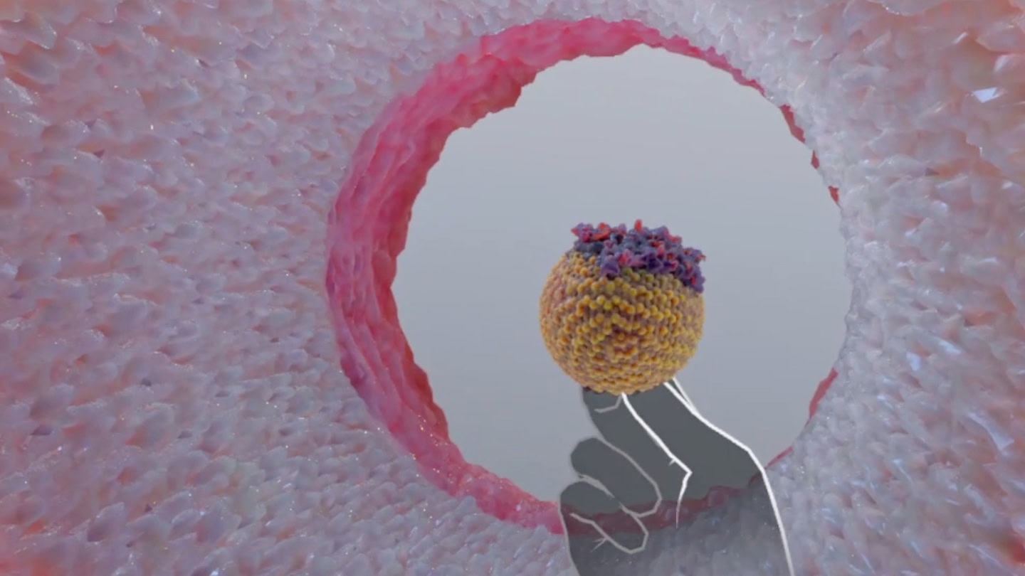 #3. Understanding Heart Attack (Meta) Tekijänä: XR Anatomy Ltd