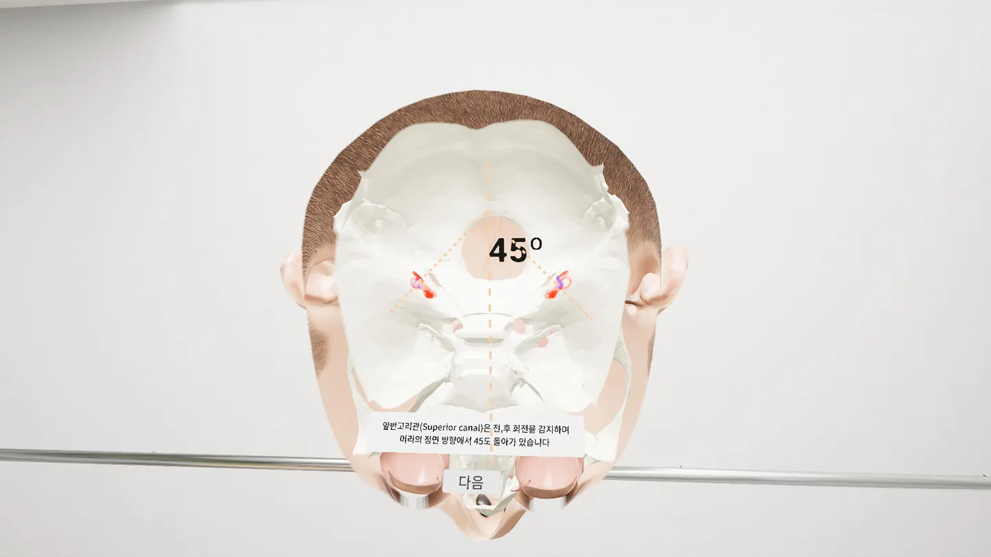 #3. VR-BPPV (Meta) Göre: vradInfo